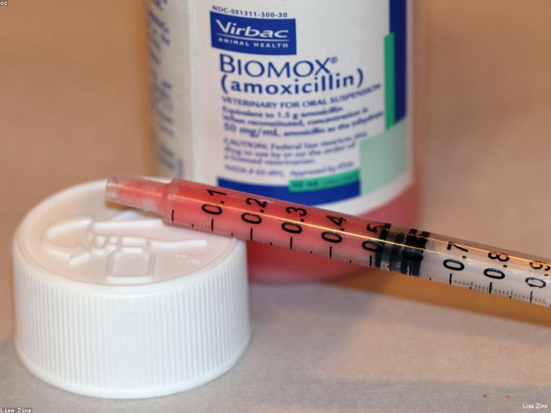 Limpieza bucal profesional: ¿Cuándo hacerla?